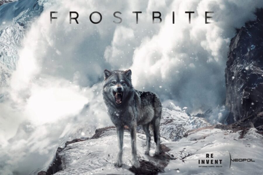Frostbite